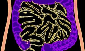 Artist's impression of the human bowel

