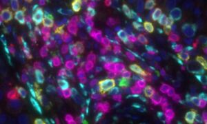 Using multiplex-immunostaining to characterise B cells. Credit: Christine 
Wagner

