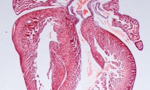Proteomic Services: supporting research into cardiac disease
