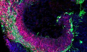 This image shows sections of the brain organoids that have been derived from 
pluripotent stem cells. The increasing use of organoids like this one be key 
to advancing personalised medicine.
