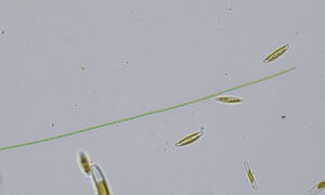 Oscillatoria redekei bacteria, observed in Rambla del Puerto del Garruchal, 
Murcia, Spain.
