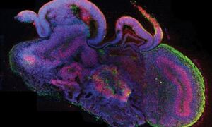 Microscopy image of cerebral organoid cross section
