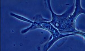 Single-cell genomics - image by Thierry Voet, Wellcome Trust Sanger Institute
