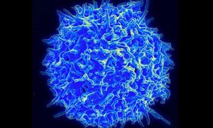 T helper cell. Credit: National Institutes of Health
